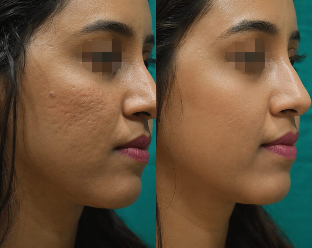 Advanced Aesthetic Skin Transformation